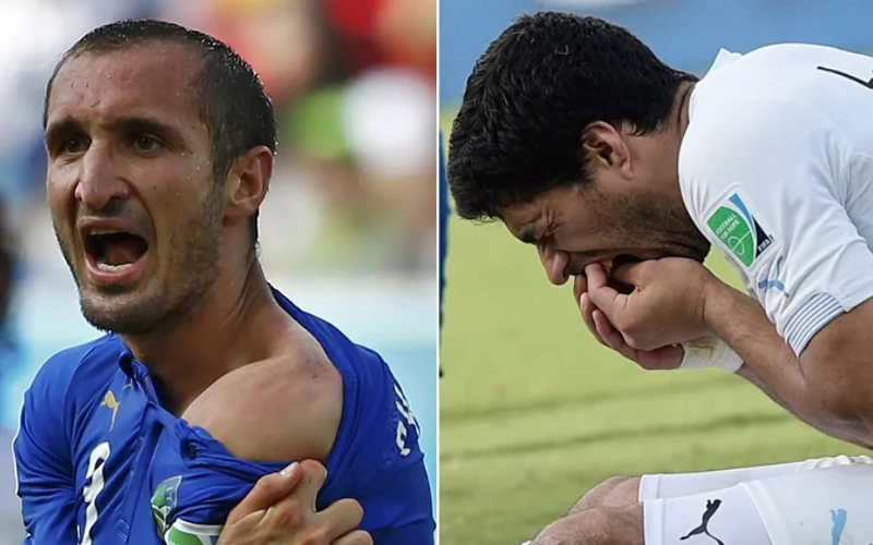 luis-suarez-futbolo-kandžiojimasis